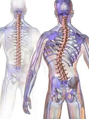 Anatomical Description Scoliosis can be described as lateral curvature of the spine usually forming a C or an S shape.