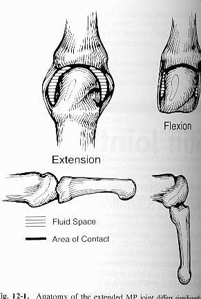 2nd to 5 MCP Joints Extension: collateral ligament is lax and the