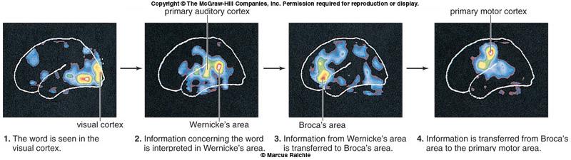 The brain: Cerebrum Cerebral hemisphere (sulci, gyri and lobes, frontal, parietal, temporal, occipital)) Cerebral cortex: thin, outer layer of gray matter:(1 B cells, sensation, movement, thinking)