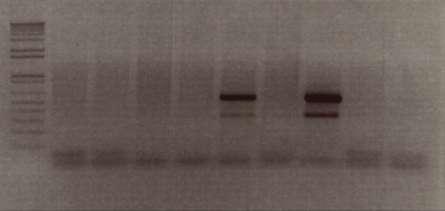 Agarose gel photo of PCR genotyping shows two mice positive for the hcd2-btbd11 transgene. (A).