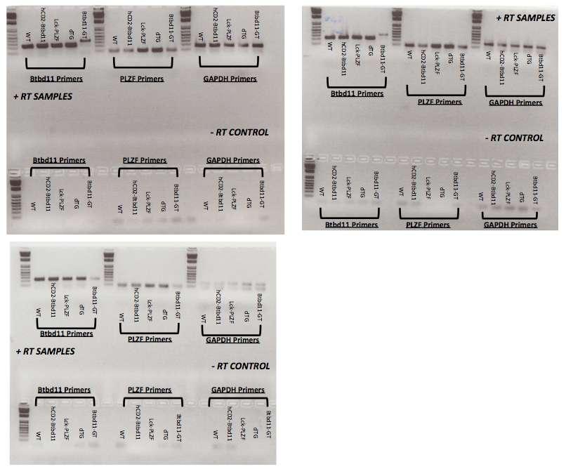A. B. 96 C. Figure 27. Validation of Btbd11, PLZF, and GAPDH qrt-pcr primers. (A). Agarose gel photo of PCR amplification of whole thymus cdna samples of the 5 experimental mice.