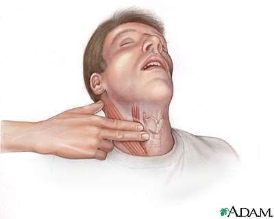 Find the carotid pulse point and GENTLY