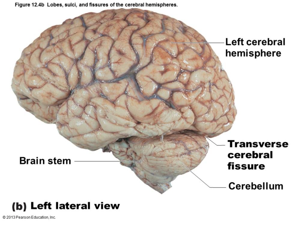 Transverse cerebral fissure