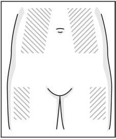 2. Sit or lie in a position so that you can see the skin where you are going to inject yourself (usually the abdomen).