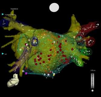 tracking with mapping/ablation catheter Reconstructs