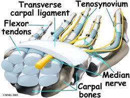 Carpal Tunnel Tunnel contains 9 flexor tendons and median nerve Roof is transverse carpal ligament CTS Any condition decreasing cross sectional are of CT or increasing volume of its contents