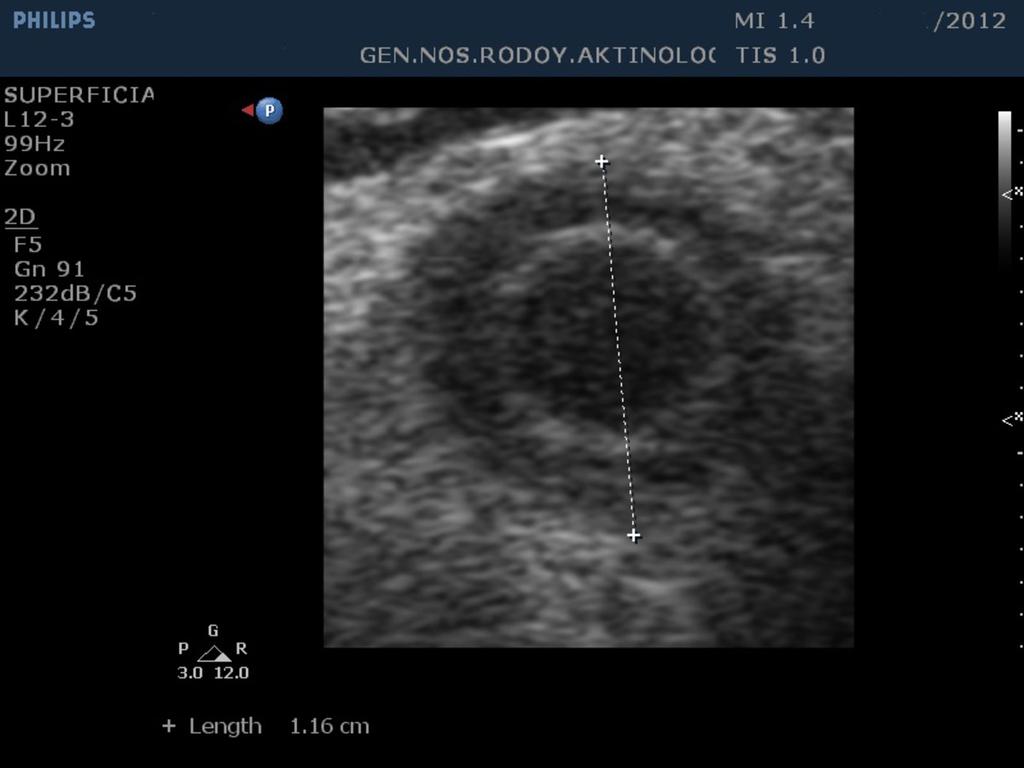 Fig. 1: Ultrasound of