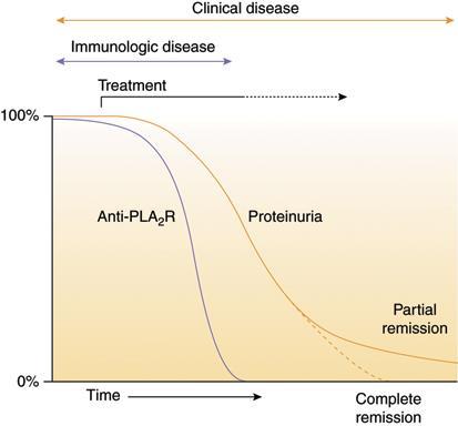 Relationship between clinical disease (proteinuria) and immunological activity (circulating anti-pla2r) in IMN Immunosuppressants Modified Ponticelli