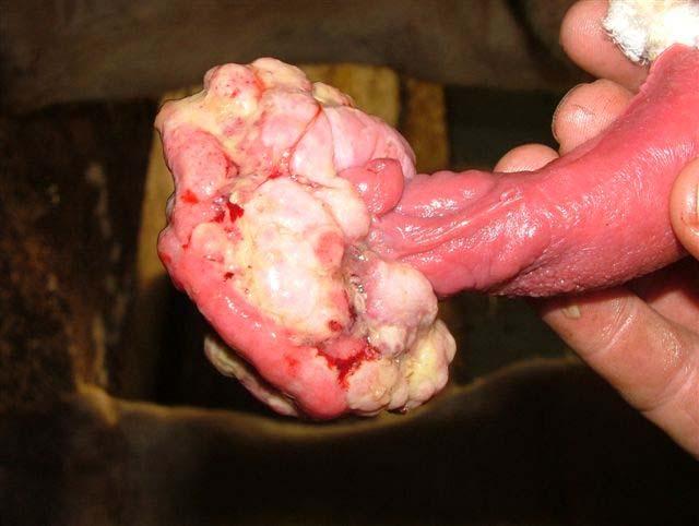 Diffuse swelling along the sheath (Fig 9) can be caused by preputial tearing with subsequent infection that will lead to adhesions and inability of the bull to fully extrude the penis.
