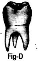Give the number of teeth in an human adult. 4.
