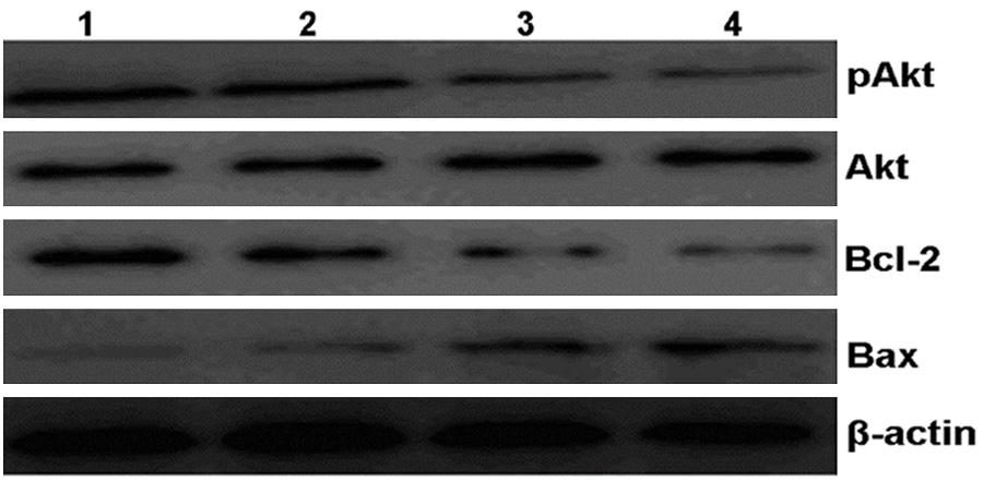 Figure 4. Bufalin modulates the activation of PI3K/Akt apthway in MCF-7 cells. Western blot analysis of the levels of Bcl-2 and Bax in differently treated MCF-7 cells: 1.0 h; 2.