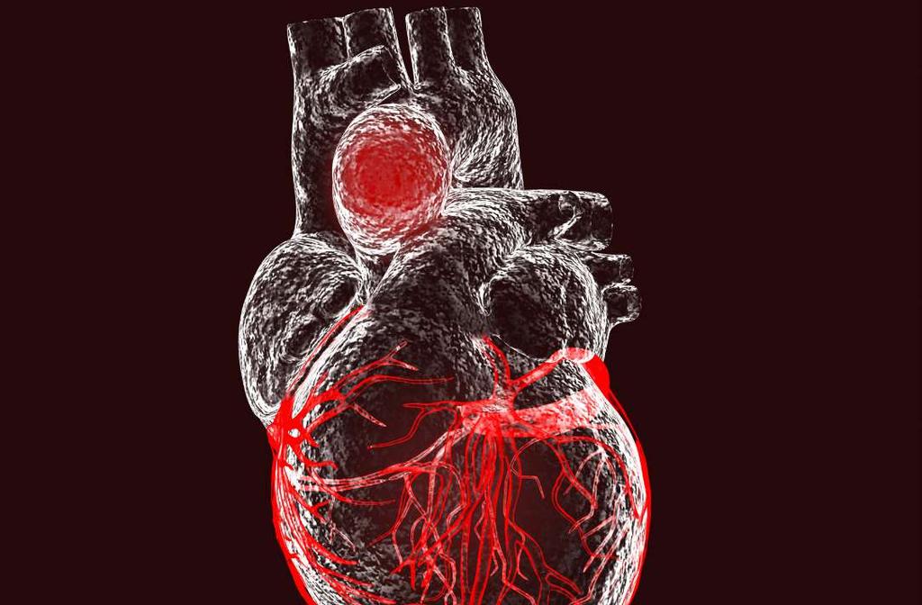 Leading services AORTIC DISEASES Aneurysm and dilation of thoracic and abdominal aorta Dissection of aorta Intramural hematoma SERVICES Imaging diagnostics: echocardiography, CT scan, cardiac MR,