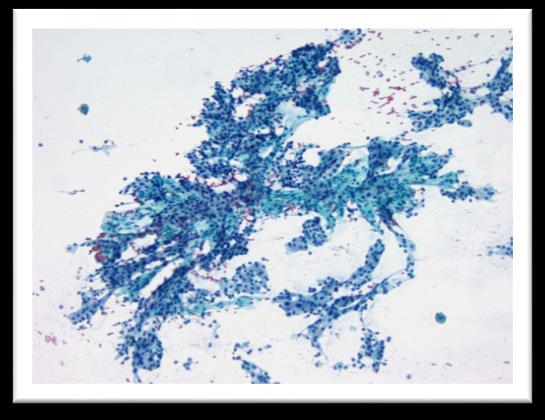 tissue Can show chief, oncocytic or clear