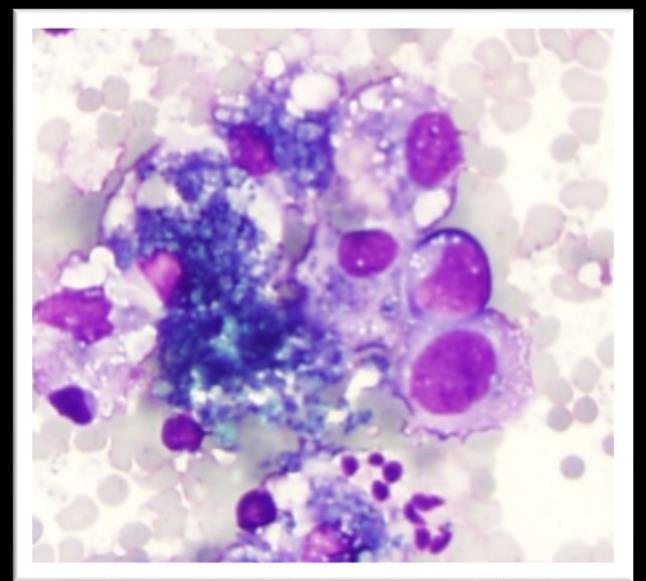 Look carefully for histiocytoid cells Adequate