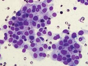 Springer 2018 Focal cytologic atypia Extensive but mild