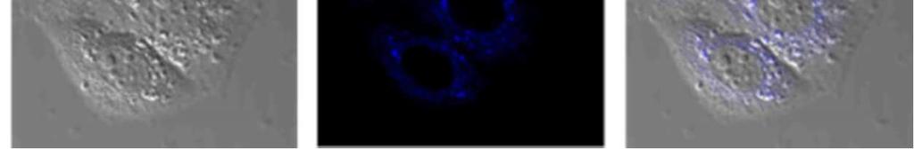HeLa cells costained only with Mito-VH; (b) Fluorescence images of (a) from FITC channel; (c) overlay of (a)