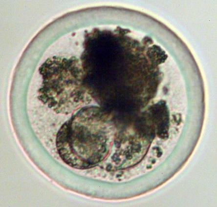 Degenerate (dead) embryos Donor Recipient Flush