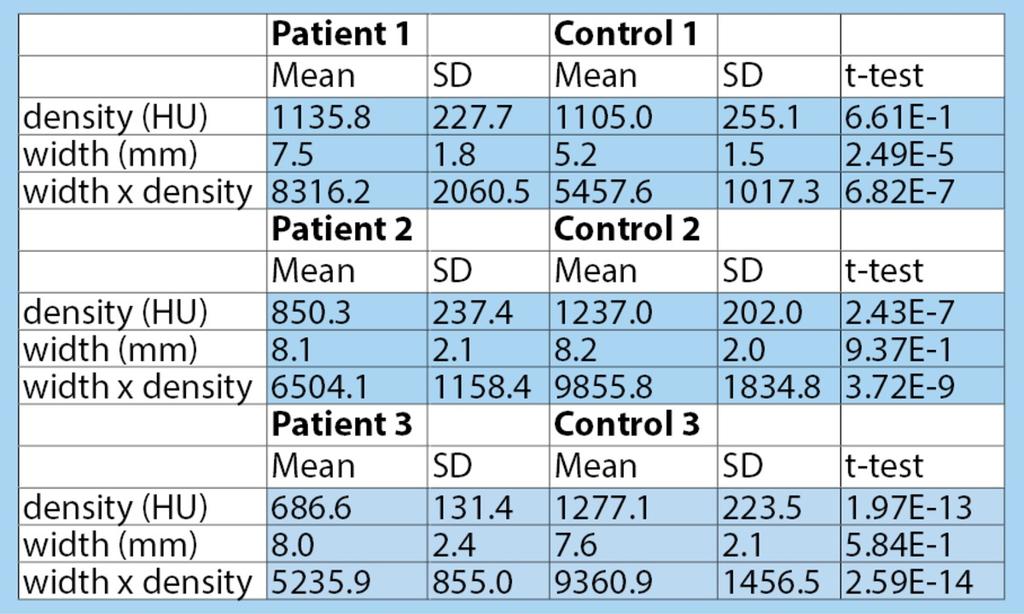 Table 1: The mean mass density (HU), width (mm), and density x width are listed for the patient and control subgroups.