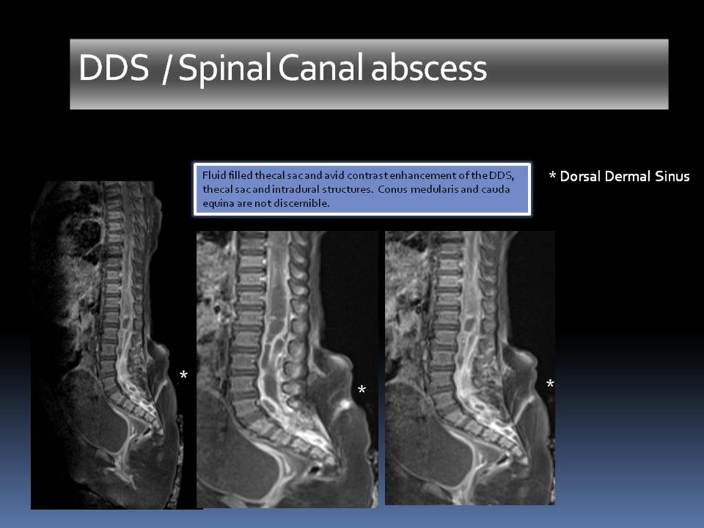 Fig. 10: MRI, sagittal T1-w fat suppressed post