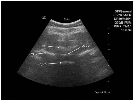 Ultrasonography