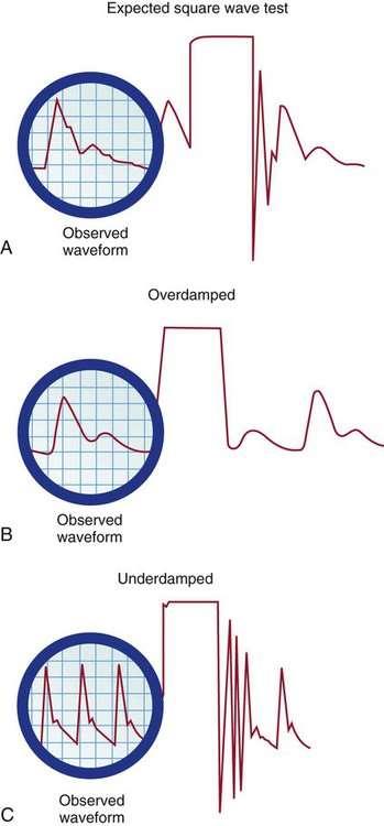 Pressure-difference in systolic and diastolic ACCURACY OF