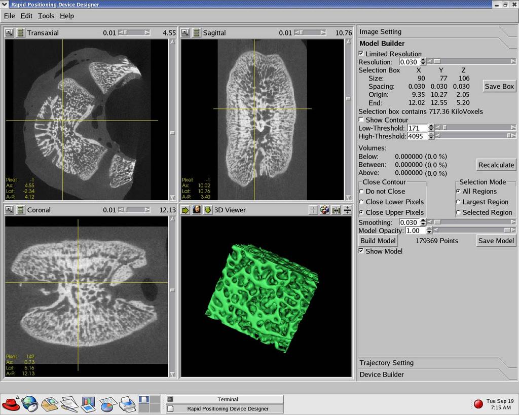 microct samples at 30 microns (SCANCO Switzerland) Select threshold value to autosegment trabecular