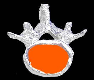 TIM, TBV, TBS) microct imaging; 3D image of skeletal