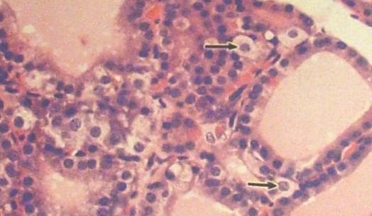 2) parafollicular cells (C cells) Location: LM: EM: pale