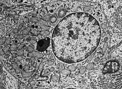 nucleus EM: mitochondria