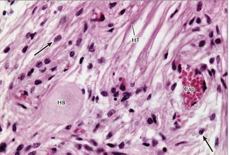 4. Neurohypophysis 1) unmyelinated nerve fibers 2)
