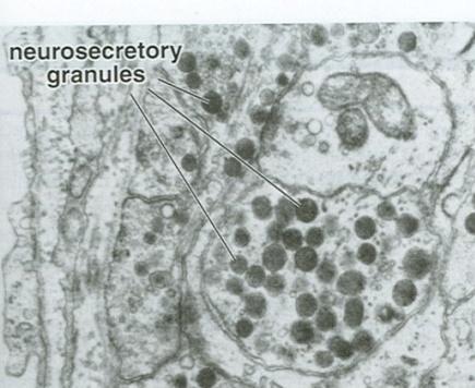 bodies (neurosecretory b~) faintly eosinophilic 室旁核视上核