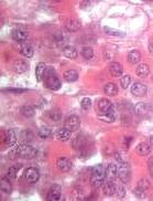 acidophils somatotropic cells chromophils