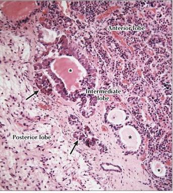2) pars intermedia follicles & cords chromophobes