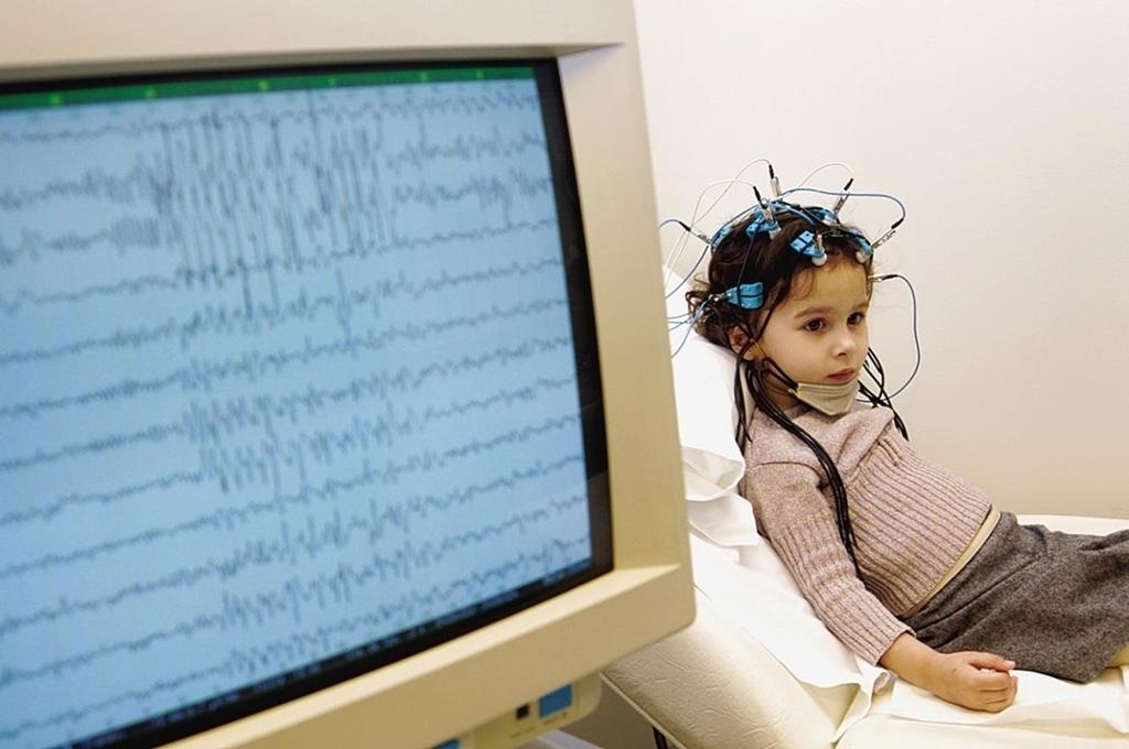 Electroencephalogram (EEG) An amplified recording of the electrical waves sweeping across the
