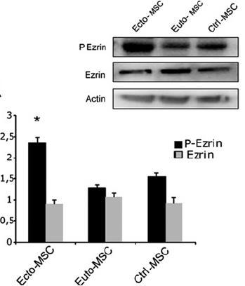 ANTI-MIGRATION EFFECT OF SORAFENIB Ezrin: cytosckeletal protein