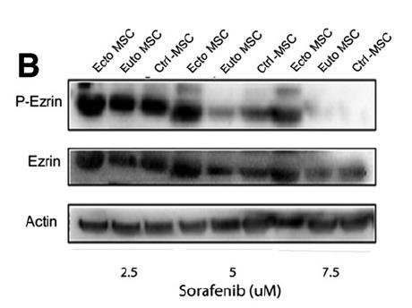 phosphorilated (Ezrin-P) Sorafenib has dose-dependent effect
