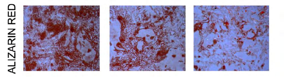 14 days Cytokeratin staining +, E-cadherin staining - Differentiation to