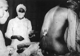 Case I:Tuskegee Syphilis Study Goal: Examine natural history of