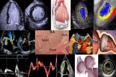 Piedmont Heart presents imagine 2018 Echocardiography Today