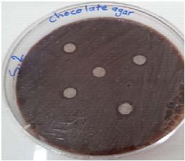 Antibacterial activity viridians Streptococci