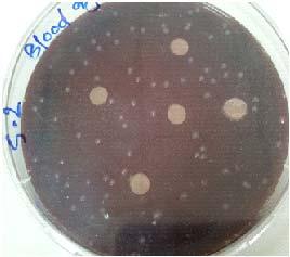 8. Antibacterial activity viridans Streptococci