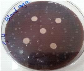 Antibacterial activity viridans Streptococci