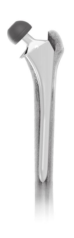 Trial Reduction Based on the final reamer and broach size, select an appropriate Stem Trial for the preparation of femoral canal.