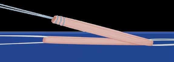 (Note: a length of 360 mm will yield a four-stranded GraftLink of at least 90 mm, which will provide at least 20 mm of graft in the femoral and tibial