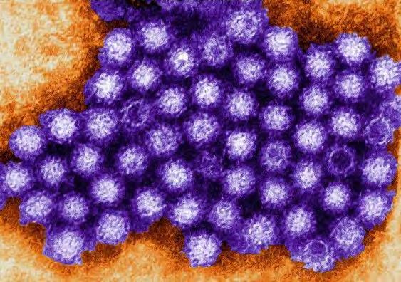 Norovirus Leading cause of viral gastroenteritis Highly infectious and environmentally stable