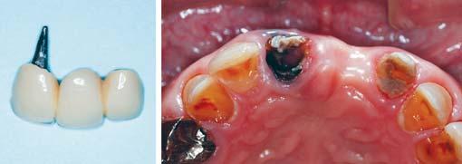 mandibular arc, 17. A diagnosis of infraocclusion was made based on these findings.
