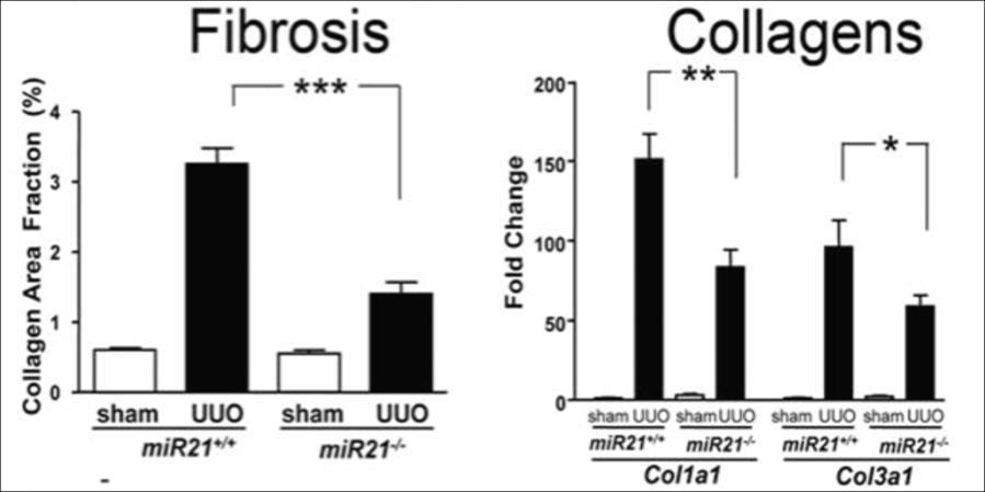 mir-21 and Kidney Fibrosis microrna-21 levels are elevated in chronic kidney disease patients and animal models of