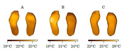 In-Home Assessment of a Smart Foot Mat for the Prevention of Diabetic Foot Ulcers