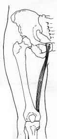 VIEW: FRONT RIGHT THIGH VEIW: BACK OF THIGH Hip Hip Femur GRACILIS Femur SEMITENDINOSUS Knee Knee Harvested Tendons.