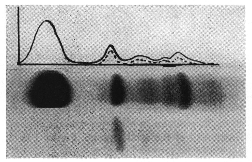 Electrophoretic strips from nonpregnant hamster serum proteins stained with fastgreen (top) and PAS (bottom). Graph is of O.D. readings, with dashed lines indicating PAS readings.